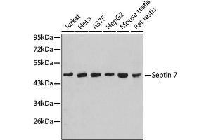Western blot analysis of extracts of various cell lines, using Septin 7 antibody (ABIN1682655, ABIN3018092, ABIN3018093 and ABIN6220357).