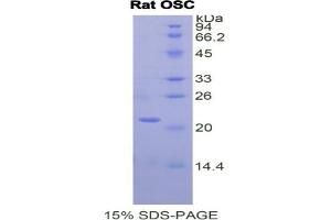 SDS-PAGE analysis of Rat Oxidosqualene Cyclase Protein. (LSS Protein)