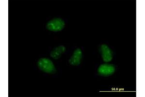 Immunofluorescence of purified MaxPab antibody to ALS2CR15 on HeLa cell. (ICA1L Antikörper  (AA 1-482))