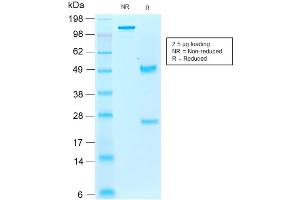 SDS-PAGE Analysis of Purified AIF1/IBA1 Mouse Recombinant Monoclonal Antibody ABIN6383787. (Rekombinanter Iba1 Antikörper)