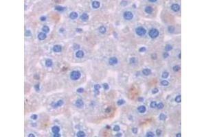 IHC-P analysis of Mouse Tissue, with DAB staining. (TXK Antikörper  (AA 286-509))