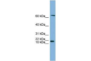 WB Suggested Anti-GM2A Antibody Titration:  0.