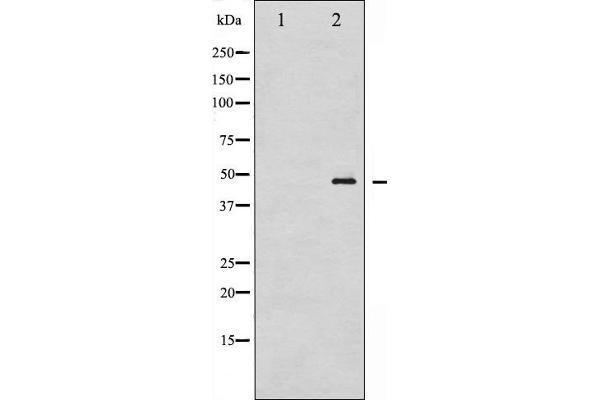 GATA1 antibody  (pSer142)