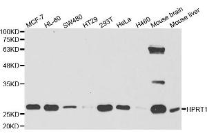 Western Blotting (WB) image for anti-Hypoxanthine phosphoribosyltransferase 1 (HPRT1) antibody (ABIN1876893) (HPRT1 Antikörper)