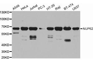 Western blot analysis of extracts of various cell lines, using NUP62 antibody (ABIN5971334) at 1/1000 dilution. (NUP62 Antikörper)