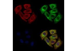 ABIN6260562 and ABIN6272683 staining Hela cells by IF/ICC. (CCR8 Antikörper  (C-Term))