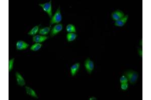 Immunofluorescence staining of Hela cells with ABIN7168823 at 1:33, counter-stained with DAPI.