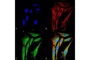 Immunocytochemistry/Immunofluorescence analysis using Mouse Anti-MMP9 Monoclonal Antibody, Clone S51-82 . (MMP 9 Antikörper  (AA 1-708) (Atto 594))