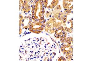 (ABIN6244121 and ABIN6578389) staining VAC14 in human kidney tissue sections by Immunohistochemistry (IHC-P - paraformaldehyde-fixed, paraffin-embedded sections). (VAC14 Antikörper  (AA 125-159))
