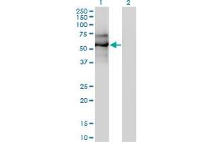 Western Blot analysis of EBF1 expression in transfected 293T cell line by EBF1 monoclonal antibody (M01A), clone 1C12. (EBF1 Antikörper  (AA 1-591))