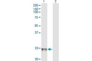 Western Blotting (WB) image for anti-RAB1B, Member RAS Oncogene Family (RAB1B) (AA 91-201) antibody (ABIN529415)