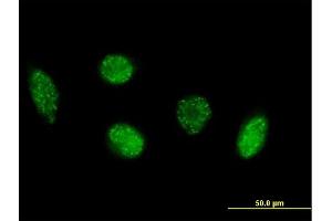 Immunofluorescence of purified MaxPab antibody to VIM on HeLa cell. (Vimentin Antikörper  (AA 1-466))
