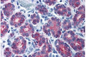 Human Breast (formalin-fixed, paraffin-embedded) stained with KRT7 antibody ABIN337389 at 10 ug/ml followed by biotinylated goat anti-rabbit IgG secondary antibody ABIN481713, alkaline phosphatase-streptavidin and chromogen. (Cytokeratin 7 Antikörper  (N-Term))