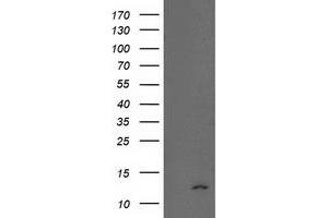 Western Blotting (WB) image for anti-NADH Dehydrogenase (Ubiquinone) 1 alpha Subcomplex, 7, 14.5kDa (NDUFA7) antibody (ABIN1499659) (NDUFA7 Antikörper)