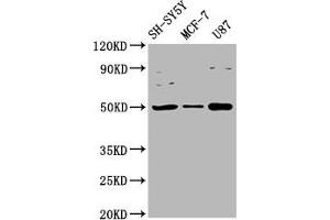 Western Blot Positive WB detected in: SH-SY5Y whole cell lysate, MCF-7 whole cell lysate, U87 whole cell lysate All lanes: IGHM antibody at 3. (IGHM Antikörper  (AA 45-178))