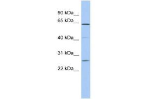 WB Suggested Anti-FAM71B Antibody Titration: 0. (FAM71B Antikörper  (Middle Region))