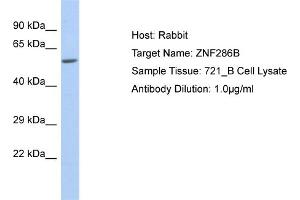 Host: Rabbit Target Name: ZNF286B Sample Type: 721_B Whole cell lysates Antibody Dilution: 1. (ZNF286B Antikörper  (N-Term))