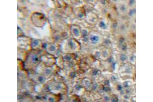 Used in DAB staining on fromalin fixed paraffin-embedded liver tissue (CD101 Antikörper  (AA 566-784))