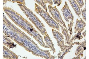 IHC analysis of RET using anti-RET antibody (ABIN6719502).