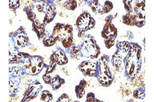 Formalin-fixed, paraffin-embedded human placenta stained with CD34 antibody (QBEnd/10 + HPCA1/763) (CD34 Antikörper)