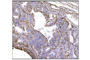 IHC analysis of NDEL1 using anti-NDEL1 antibody (ABIN7602511). (NDEL1 Antikörper  (AA 80-320))