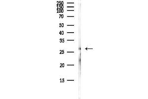 Western blot analysis of lysates from Hela cells(heat-shock,45 min treatment), using CACNG6 Antibody at 1/1000 dilution.