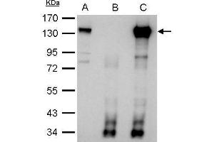 IP Image CIZ1 antibody immunoprecipitates CIZ1 protein in IP experiments. (CIZ1 Antikörper)