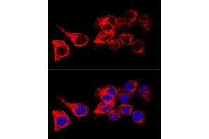 Immunofluorescence (IF) image for anti-Keratin 17 (KRT17) (AA 133-432) antibody (ABIN3023124)