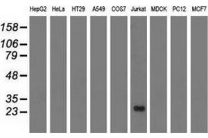 Western blot analysis of extracts (35 µg) from 9 different cell lines by using anti-RIT2 monoclonal antibody. (RIT2 Antikörper)