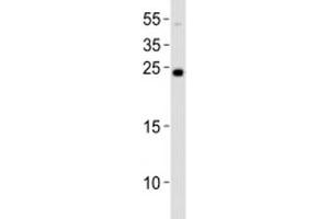Western blot analysis of lysate from NCCIT cell line using LIN28A antibody at 1:1000. (LIN28A Antikörper  (N-Term))