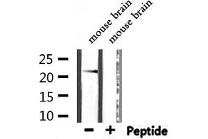 Western blot analysis of extracts from mouse brain, using CYBA Antibody. (CYBA Antikörper  (N-Term))