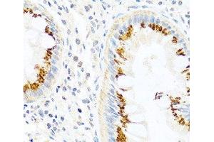 Immunohistochemistry of paraffin-embedded Human colon using FAM3B Polyclonal Antibody at dilution of 1:100 (40x lens). (FAM3B Antikörper)