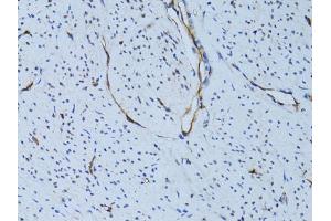 Immunohistochemistry of paraffin-embedded human uterus using SELE Antibody (ABIN5971217) at dilution of 1/100 (40x lens). (Selectin E/CD62e Antikörper)