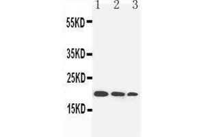 Anti-IL-10 antibody, Western blotting Lane 1: Recombinant Human IL-10 Protein 10ng Lane 2: Recombinant Human IL-10 Protein 5ng Lane 3: Recombinant Human IL-10 Protein 2. (IL-10 Antikörper  (N-Term))