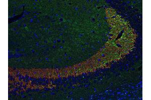 Indirect immunostaining of PFA fixed paraffin embedded mouse hippocampus section with anti-Synaptoporin (dilution 1 : 500; red) and chicken anti-Tau (, dilution 1 : 500; green). (Synaptoporin Antikörper  (C-Term))