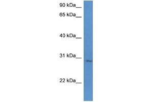 WB Suggested Anti-UTP23 Antibody Titration: 0. (UTP23 Antikörper  (C-Term))