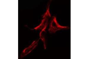 ABIN6275115 staining HuvEc cells by IF/ICC. (KDELR2 Antikörper  (Internal Region))