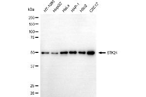 anti-serine/threonine Kinase 24 (STK24) antibody
