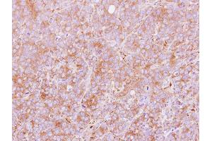 Immunohistochemistry (IHC) image for anti-Protein Disulfide Isomerase Associated 5 (PDIA5) antibody (ABIN2856995)