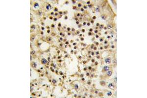 Immunohistochemical staining of formalin-fixed and paraffin-embedded human testis tissue reacted with LIN28 monoclonal antibody  at 1:50-1:200 dilution.