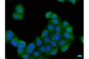 Immunofluorescence staining of Hela cells with ABIN7152261 at 1:50, counter-stained with DAPI. (EXOC8 Antikörper  (AA 508-725))