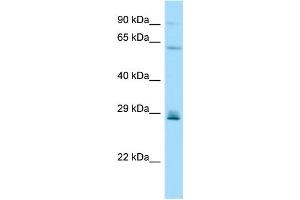 WB Suggested Anti-CD99L2 Antibody Titration: 1. (CD99L2 Antikörper  (Middle Region))
