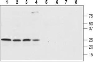 Western blot analysis of rat brain (lanes 1 and 5), rat cortex (lane 2 and 6), mouse brain (lanes 3 and 7) and SH-SY5Y (lanes 4 and 8) lysates:1-4.