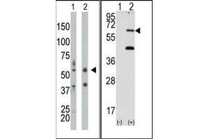 Image no. 1 for anti-Eukaryotic Translation Initiation Factor 2-alpha Kinase 2 (EIF2AK2) (N-Term) antibody (ABIN360663) (EIF2AK2 Antikörper  (N-Term))