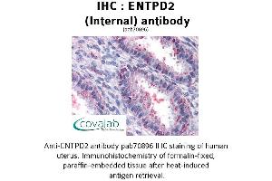 Image no. 2 for anti-Ectonucleoside Triphosphate diphosphohydrolase 2 (ENTPD2) (Internal Region) antibody (ABIN1734057)