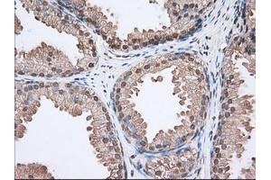 Immunohistochemical staining of paraffin-embedded Human lung tissue using anti-ACAT2 mouse monoclonal antibody. (ACAT2 Antikörper)