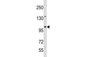 Western Blotting (WB) image for anti-Establishment of Cohesion 1 Homolog 1 (ESCO1) antibody (ABIN3004513) (ESCO1 Antikörper)