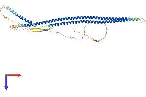 KRT14 Protein (AA 1-472) (His tag)