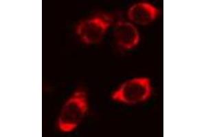 ABIN6266984 staining Hela cells by IF/ICC. (STARD13 Antikörper  (N-Term))