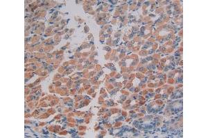 Used in DAB staining on fromalin fixed paraffin- embedded stomach tissue (EIF2AK2 Antikörper  (AA 205-495))